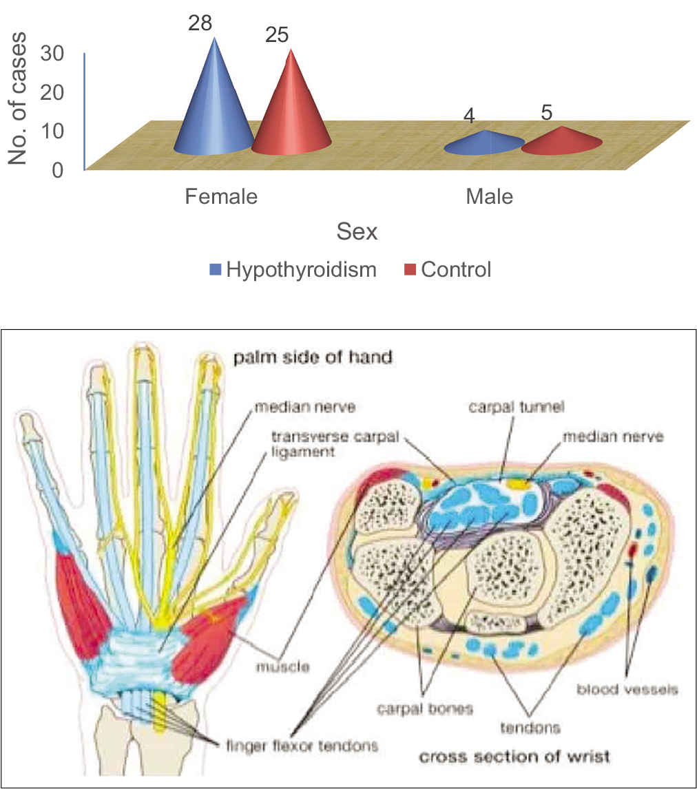 Anatomy of median nerve and flexor retinaculum.[4]