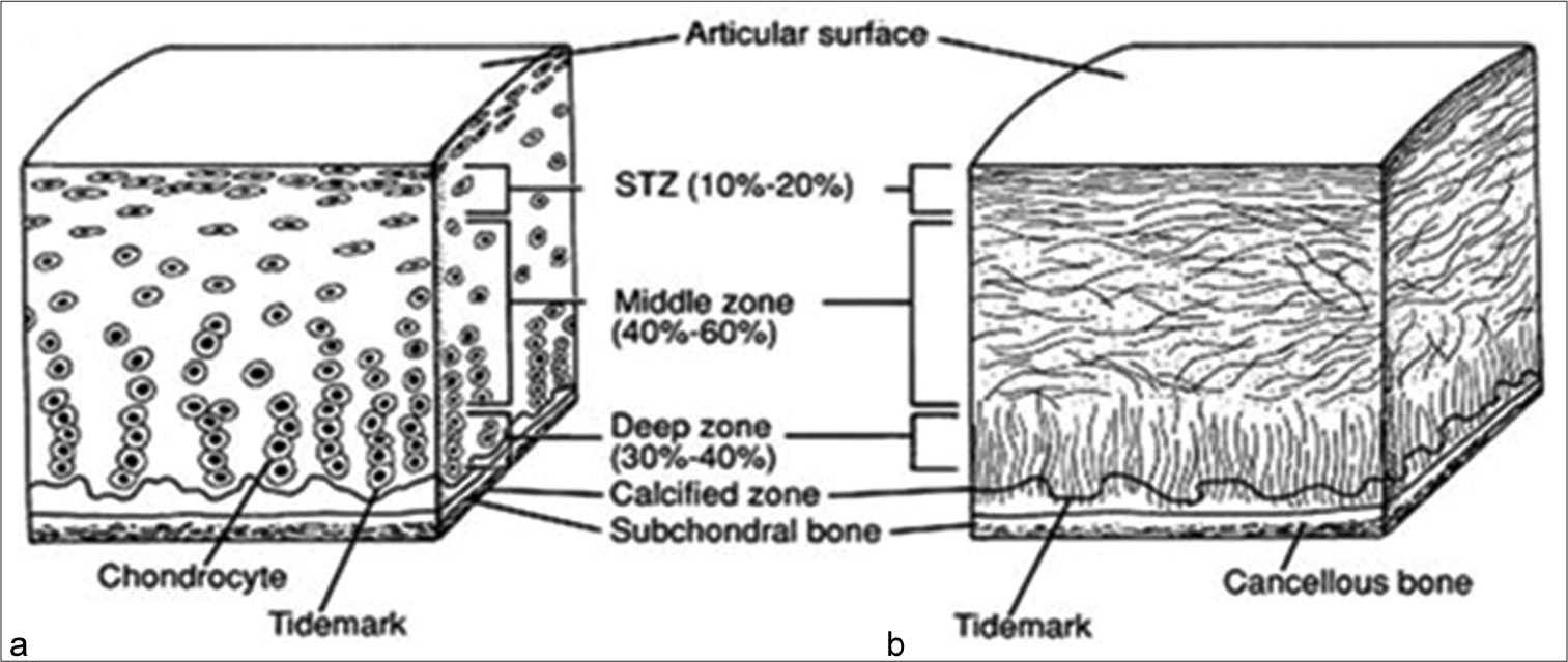 Structure of articular cartilage. (a) Histologic section of cartilage from a young, healthy adult shows even safranin O staining and distribution of chondrocytes. (b) Schematic diagram of chondrocyte organization. Adapted from: Buckwalter et al. (1994).