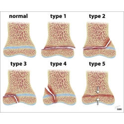 Article figure