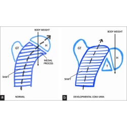 Article figure